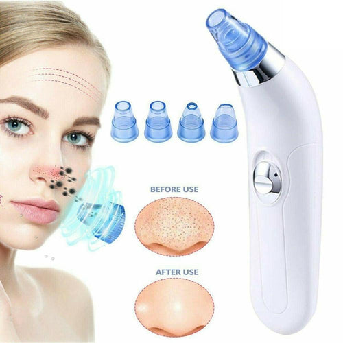 BLACKHEAD REMOVER AND PORE VACUUM CLEANER